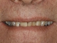 Konig Center for Cosmetic & Comprehensive Dentistry smile photos